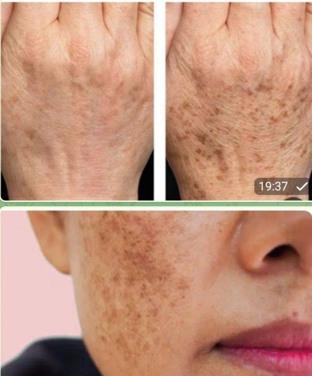 طب سنتی/درمان با داروی گیاهی