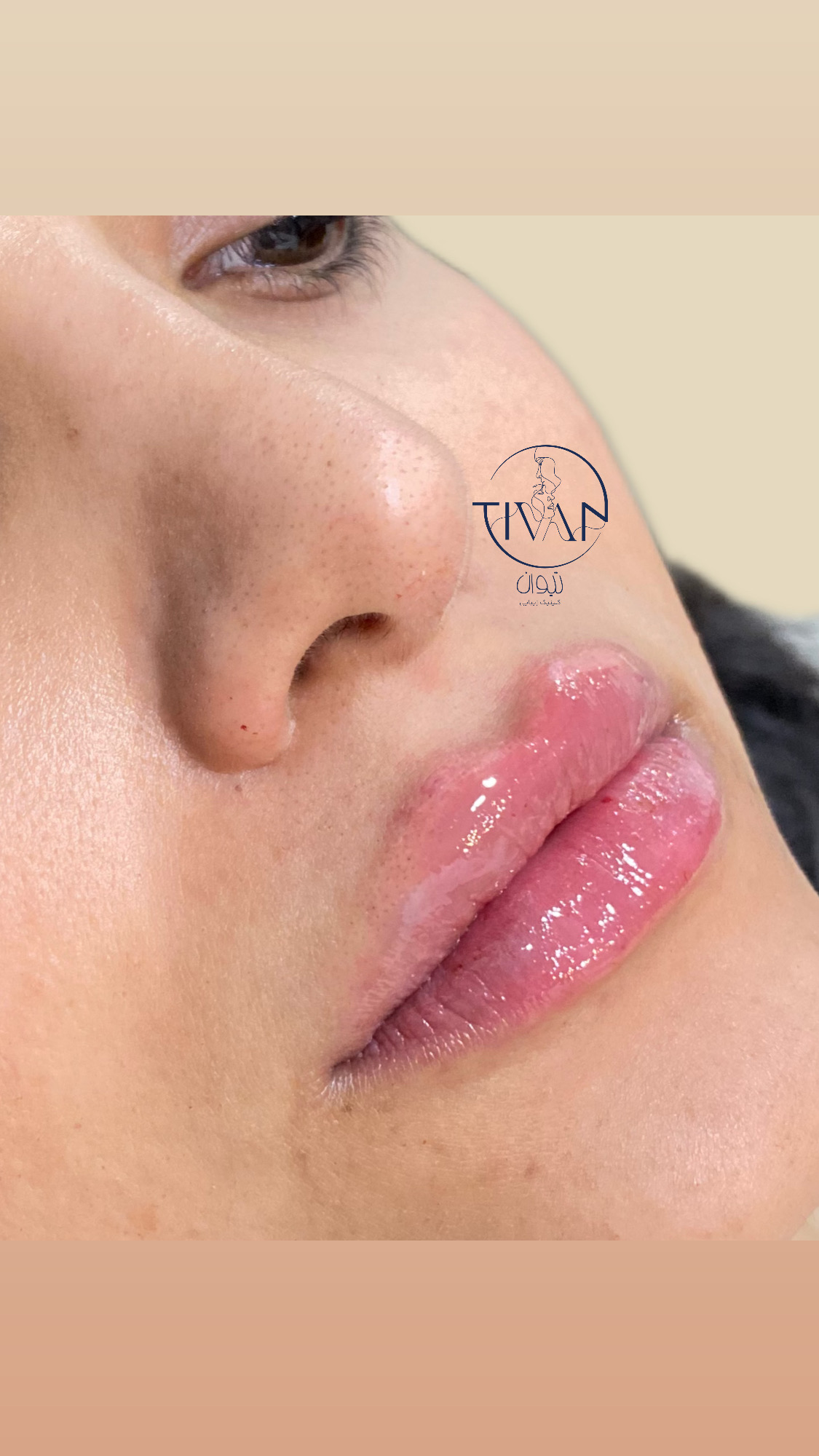 تزریقات زیبایی