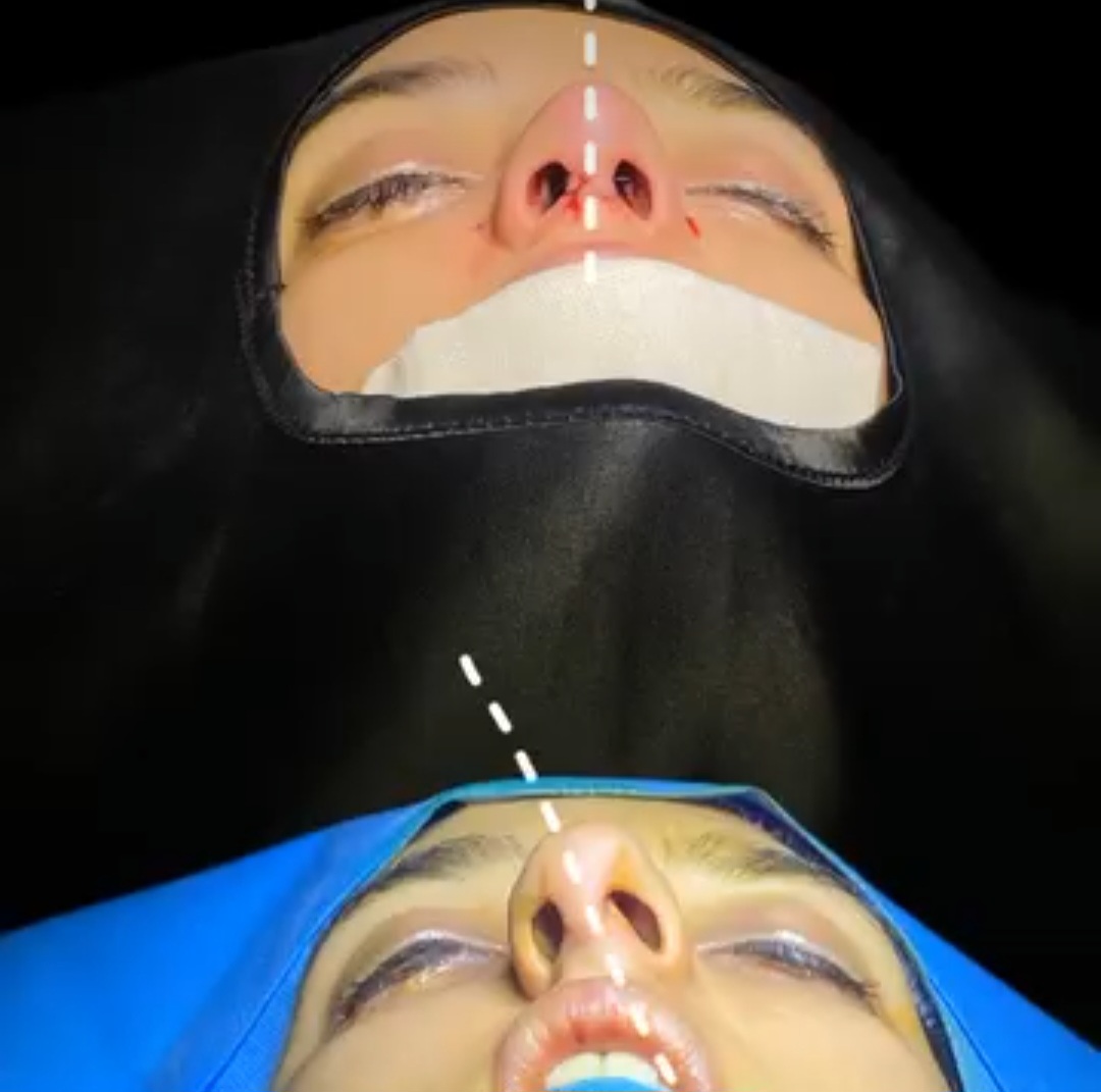 جراحی زیبایی