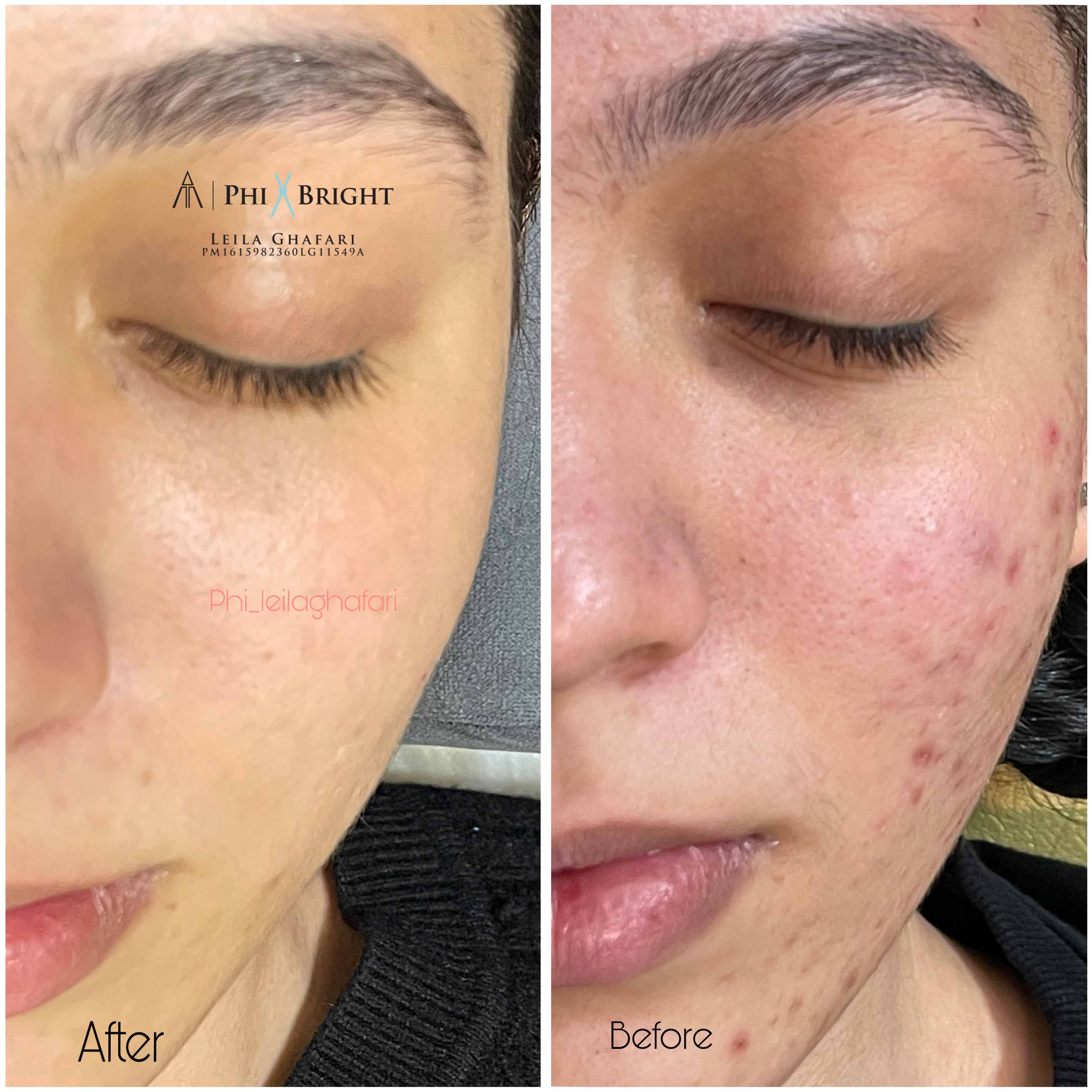 درمان قطعی انواع لک و تیرگی 