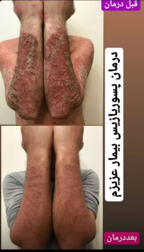 محصولات نیوشا 