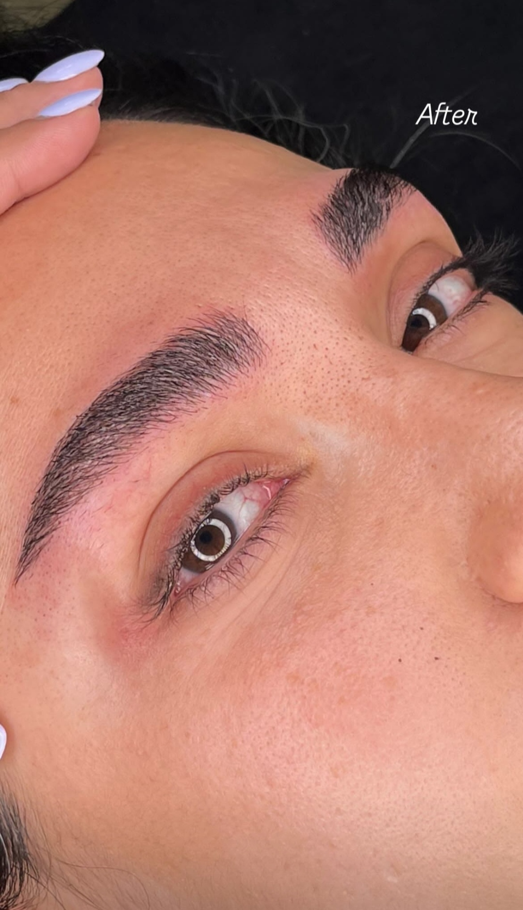 میکرو بلیدینگ نچرال بروز 