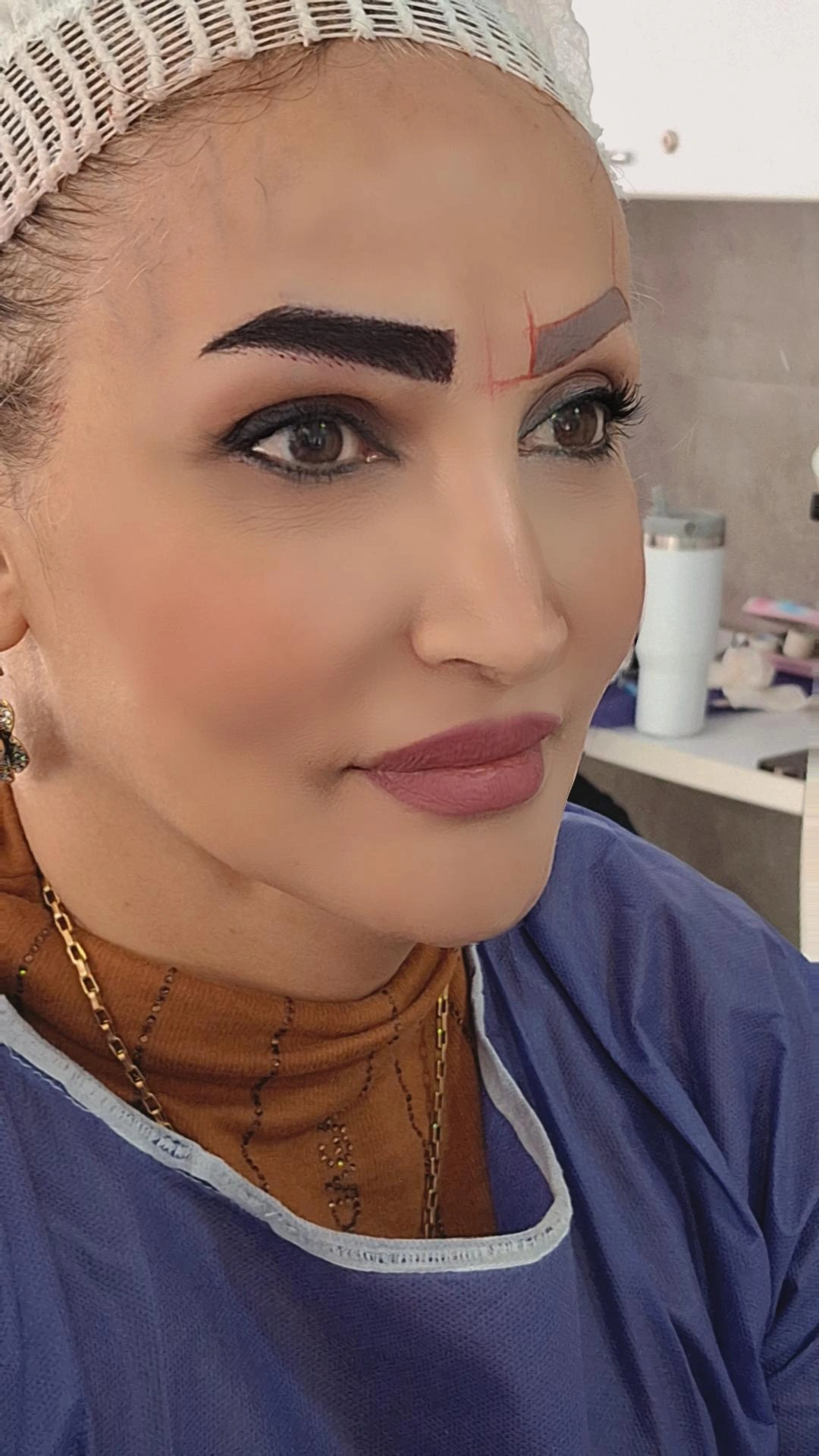  پیوندکاشت ابرو