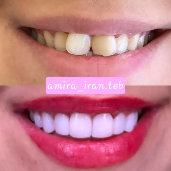 Beauty surgery and treatment