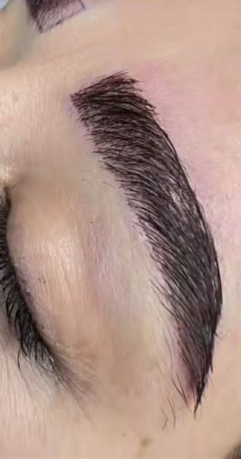 کاشت مو و ابرو 