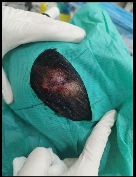 فروش زالو و لوازم پزشکی