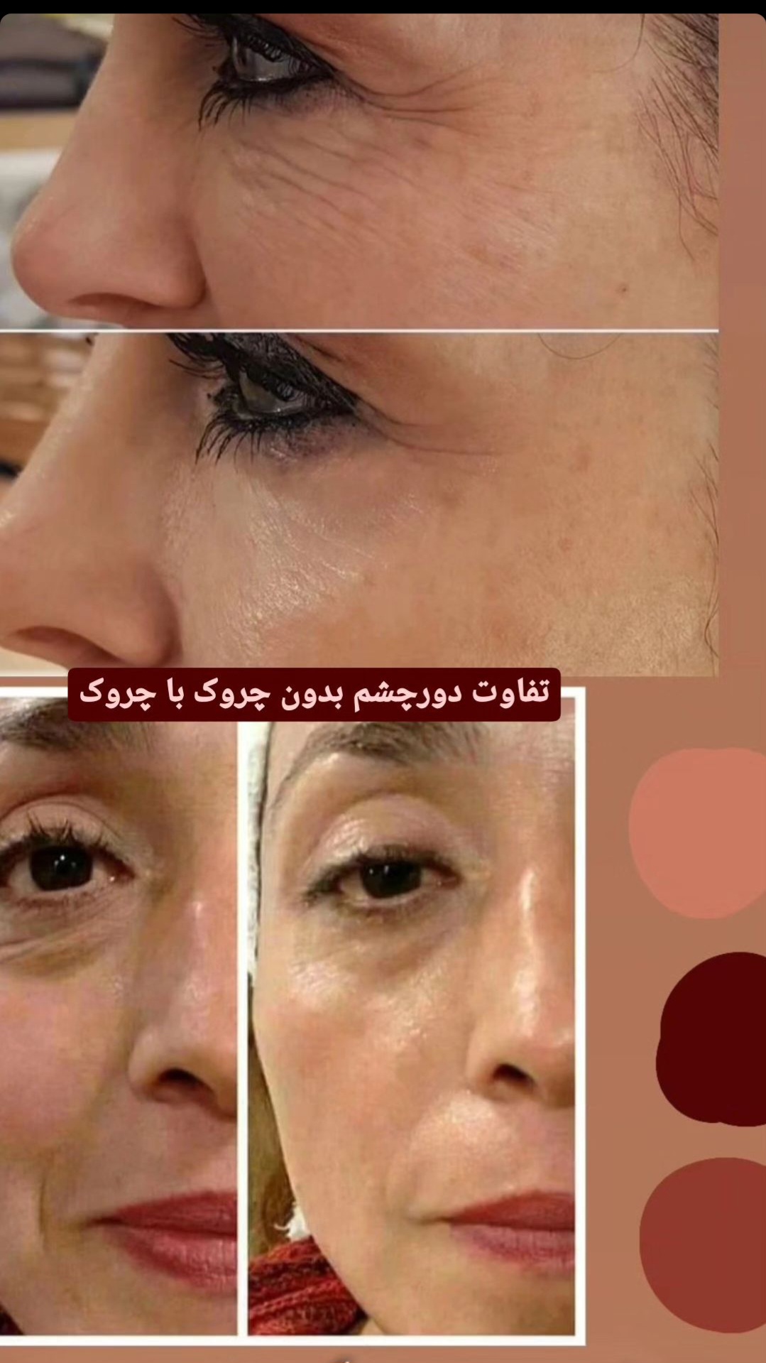 کرم سفت کننده صورت وایپر  لدورا