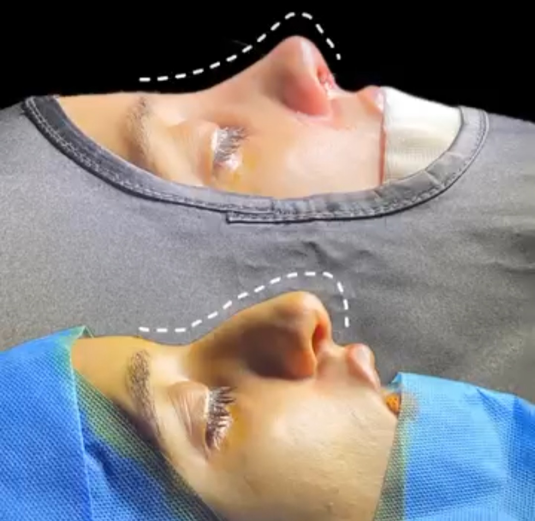 جراحی زیبایی