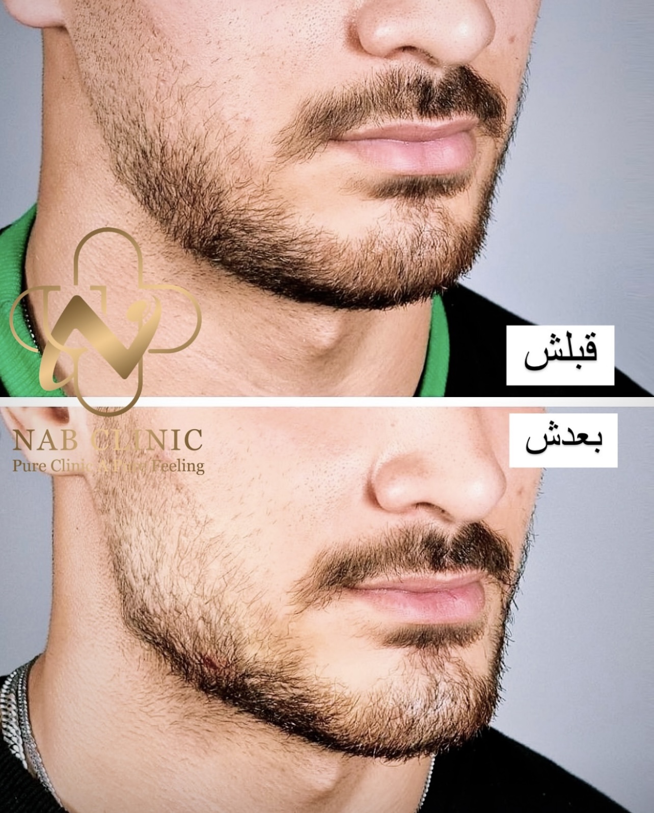  تزریق تمای کارهای زیبایی صورت و بدن
