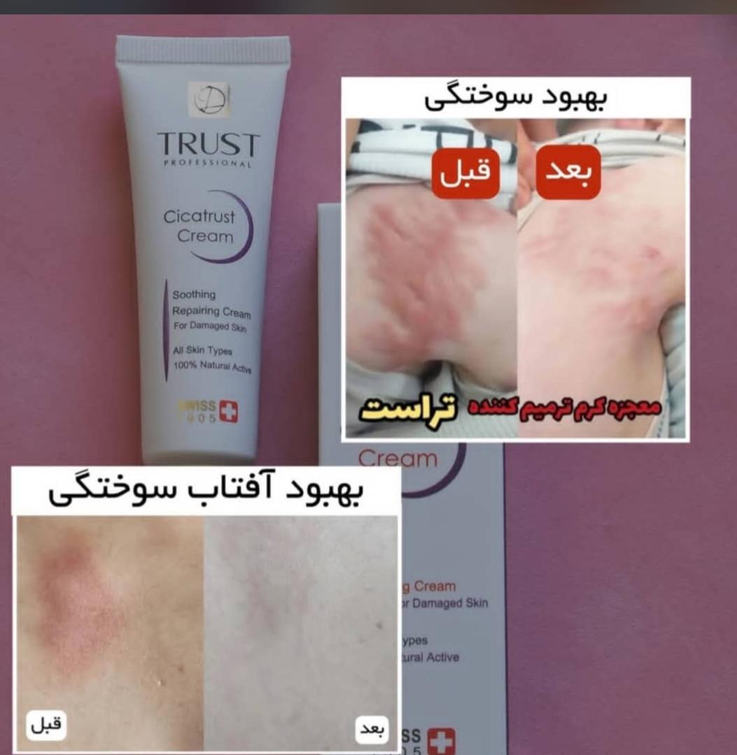 محصولات آرایشی بهداشتی درمانی تراست
