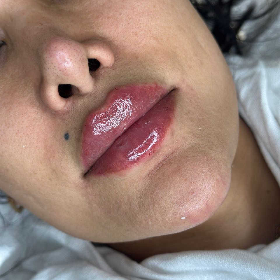 کلینیک زیبایی الا بیوتی