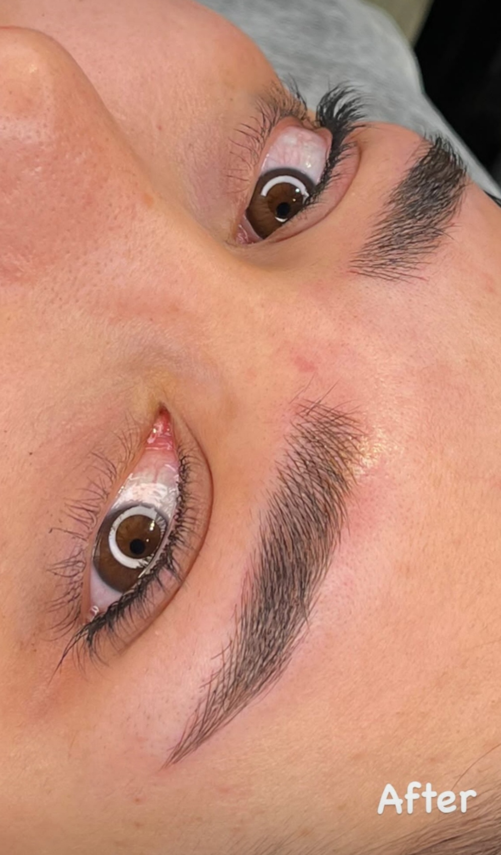 میکرو بلیدینگ نچرال بروز 