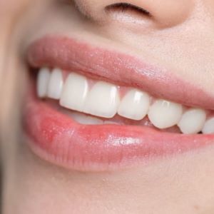 کامپوزیت زیبایی دندان