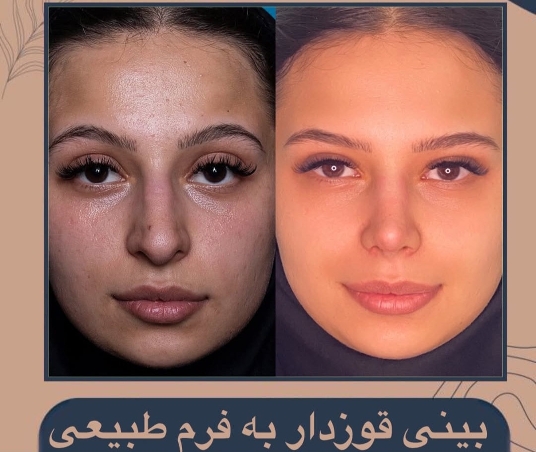 جراحی زیبایی