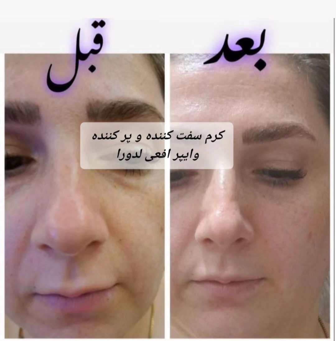 کرم سفت کننده صورت وایپر  لدورا