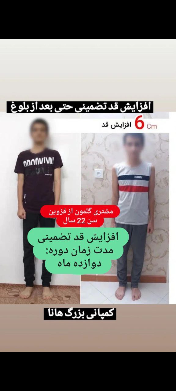 افزایش قد حتی بعد از بلوغ