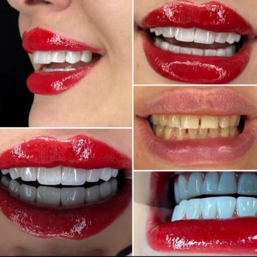 کاشت مو  جراحی زیبایی