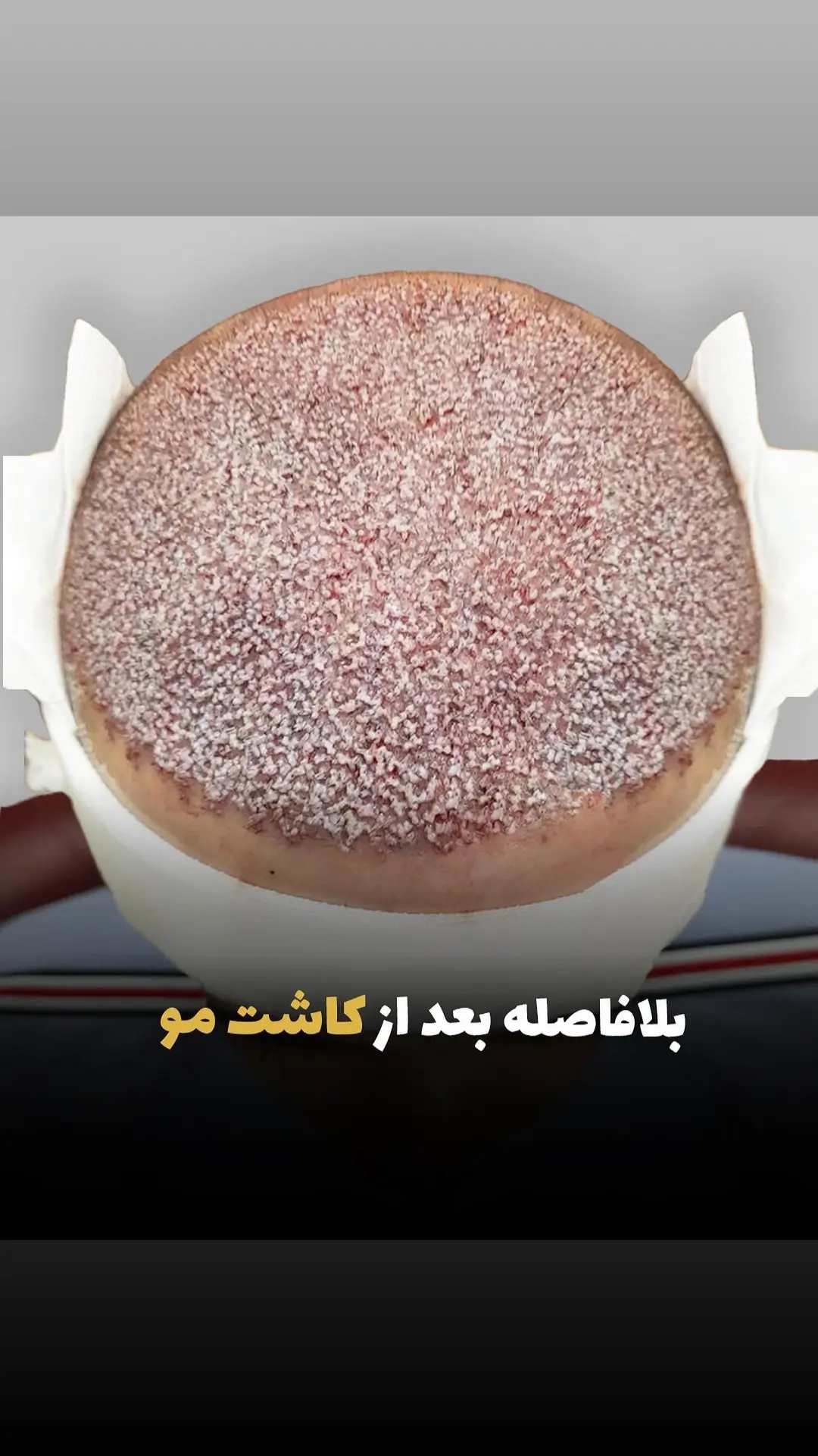 زیبایی