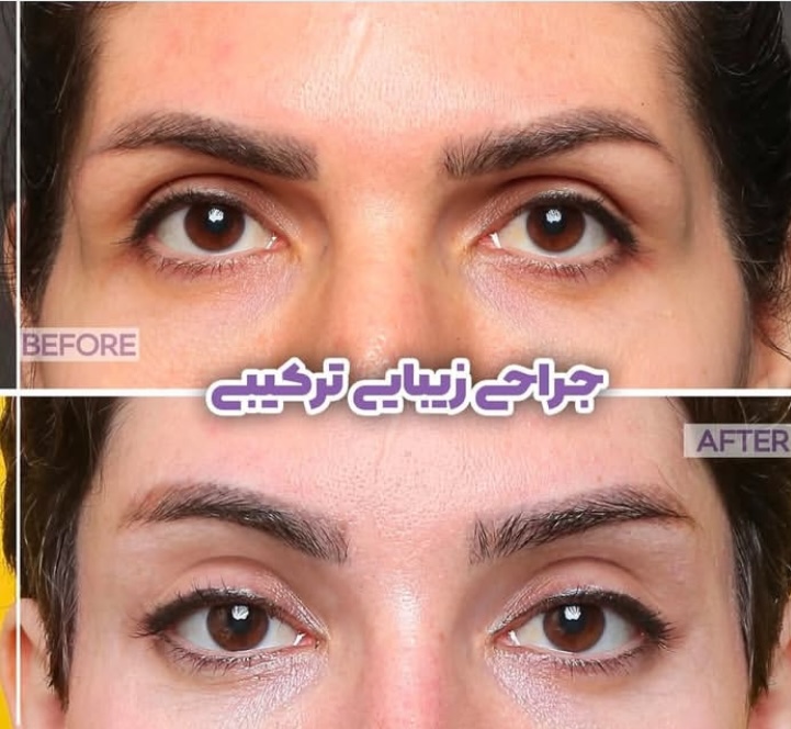 هلث توریسم