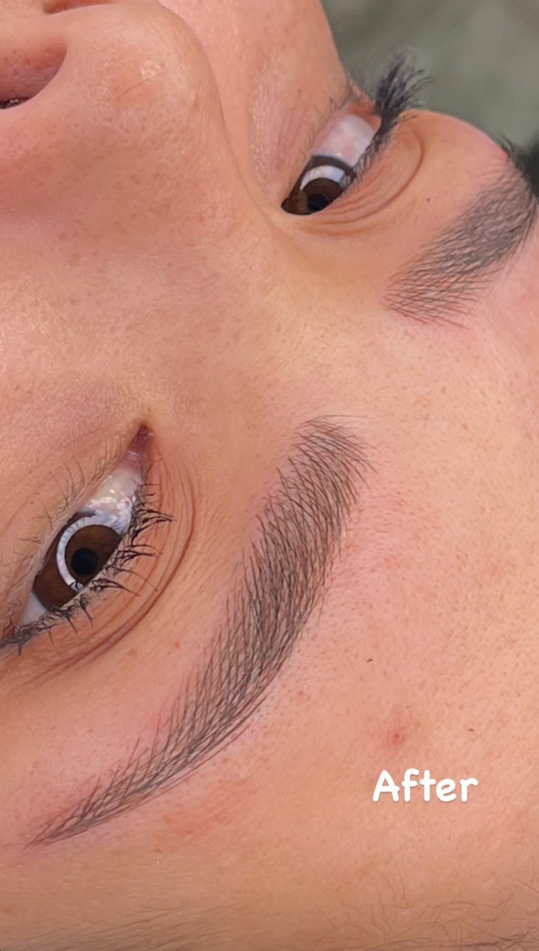 میکرو بلیدینگ نچرال بروز 