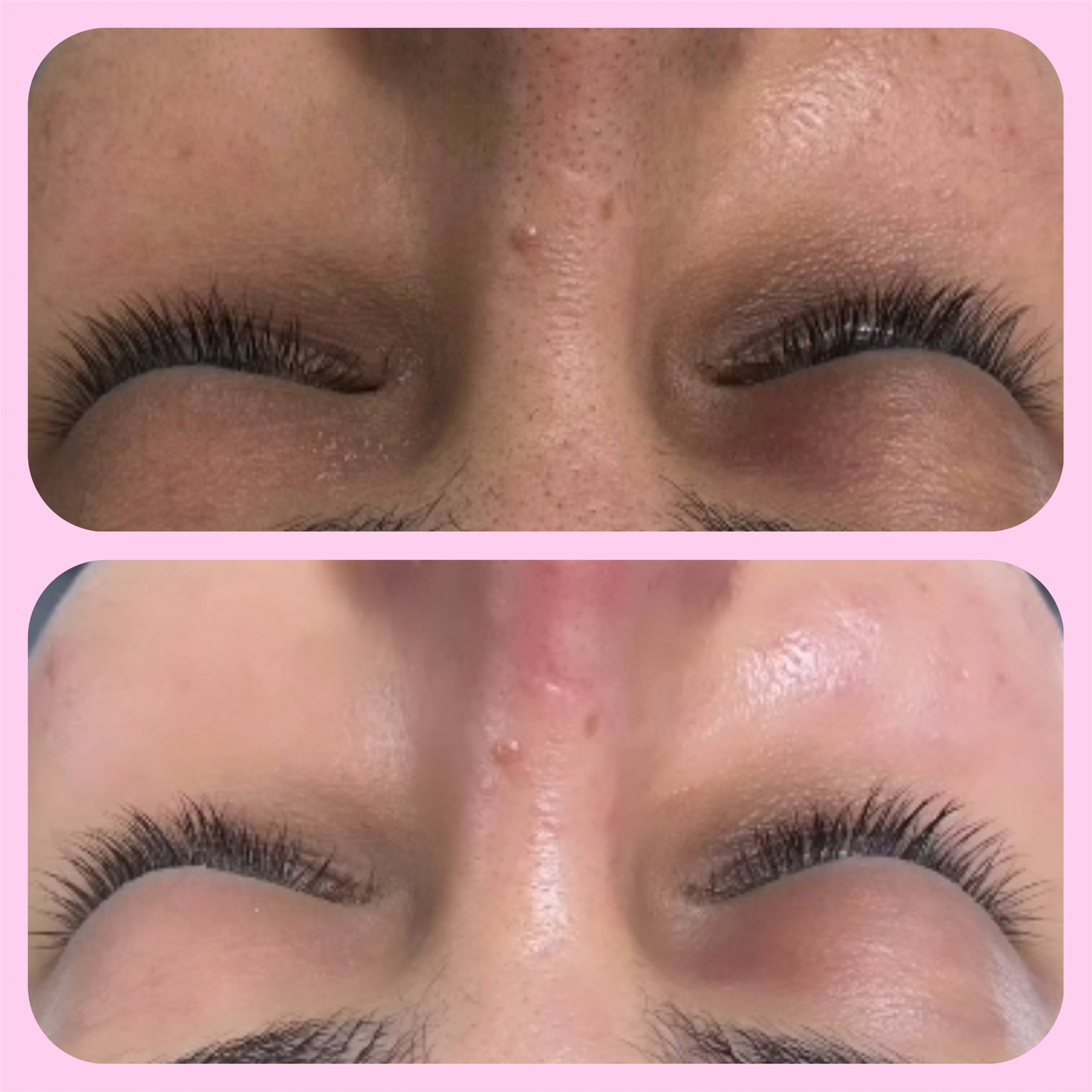 خدمات فیشال در آکادمی پوست