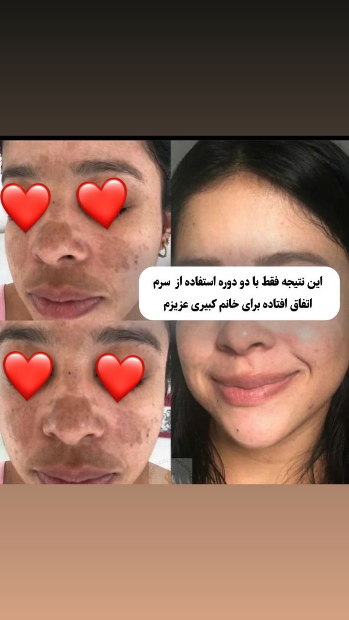 زیبایی 