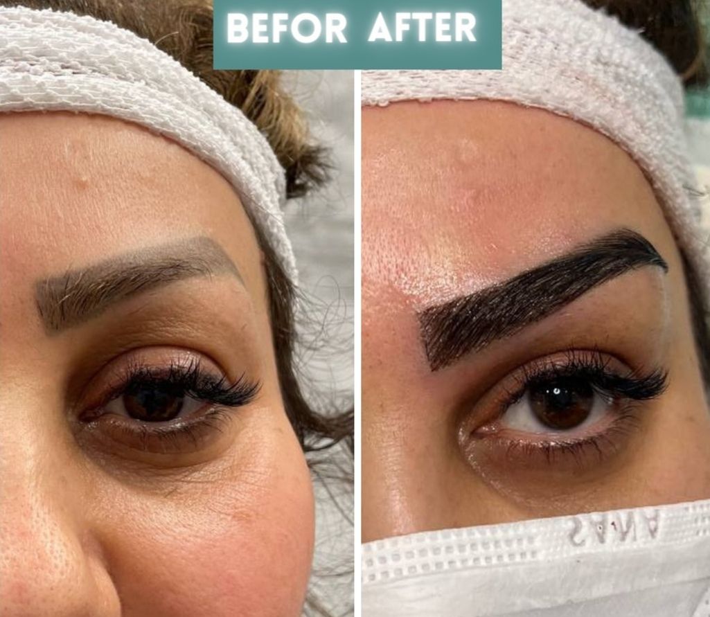 جشنواره کاشت مو ،ابرو ، ریش