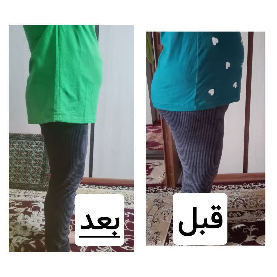 قرص ناف لاغری گیاهی