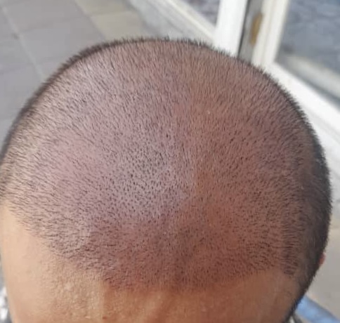 جشنواره تابستانه کاشتمو