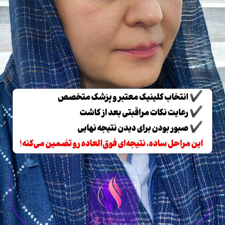 کاشت مو و کاشت ابرو 