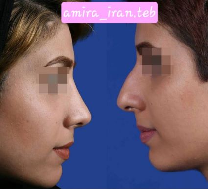 Beauty surgery and treatment