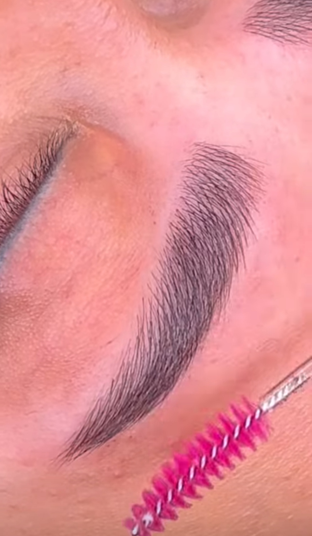 میکرو بلیدینگ نچرال بروز 