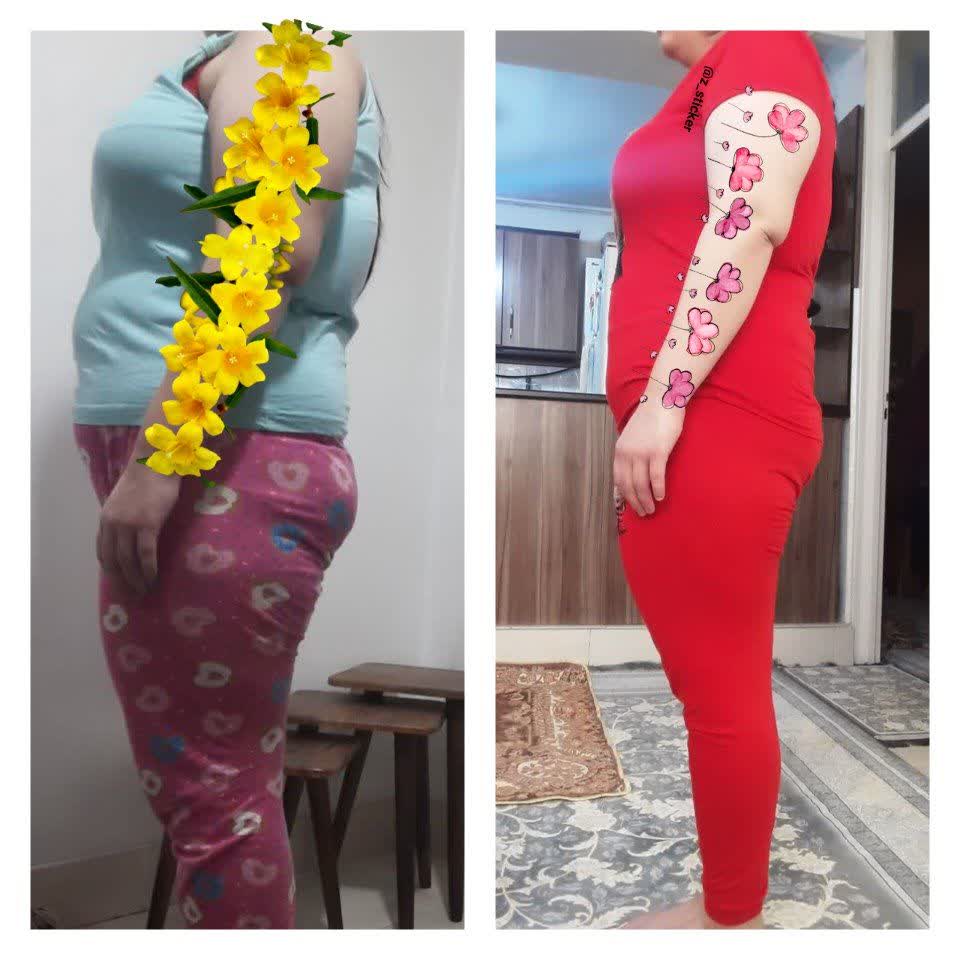 قرص ناف لاغری گیاهی