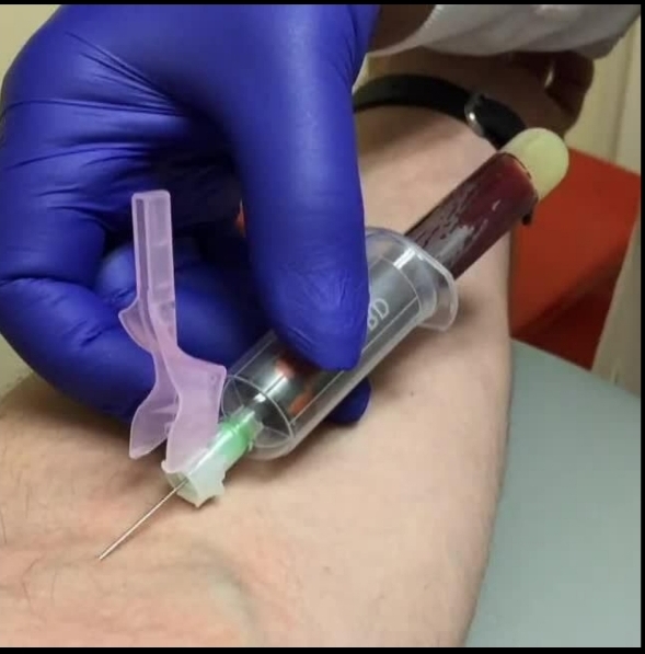 فروش زالو و لوازم پزشکی