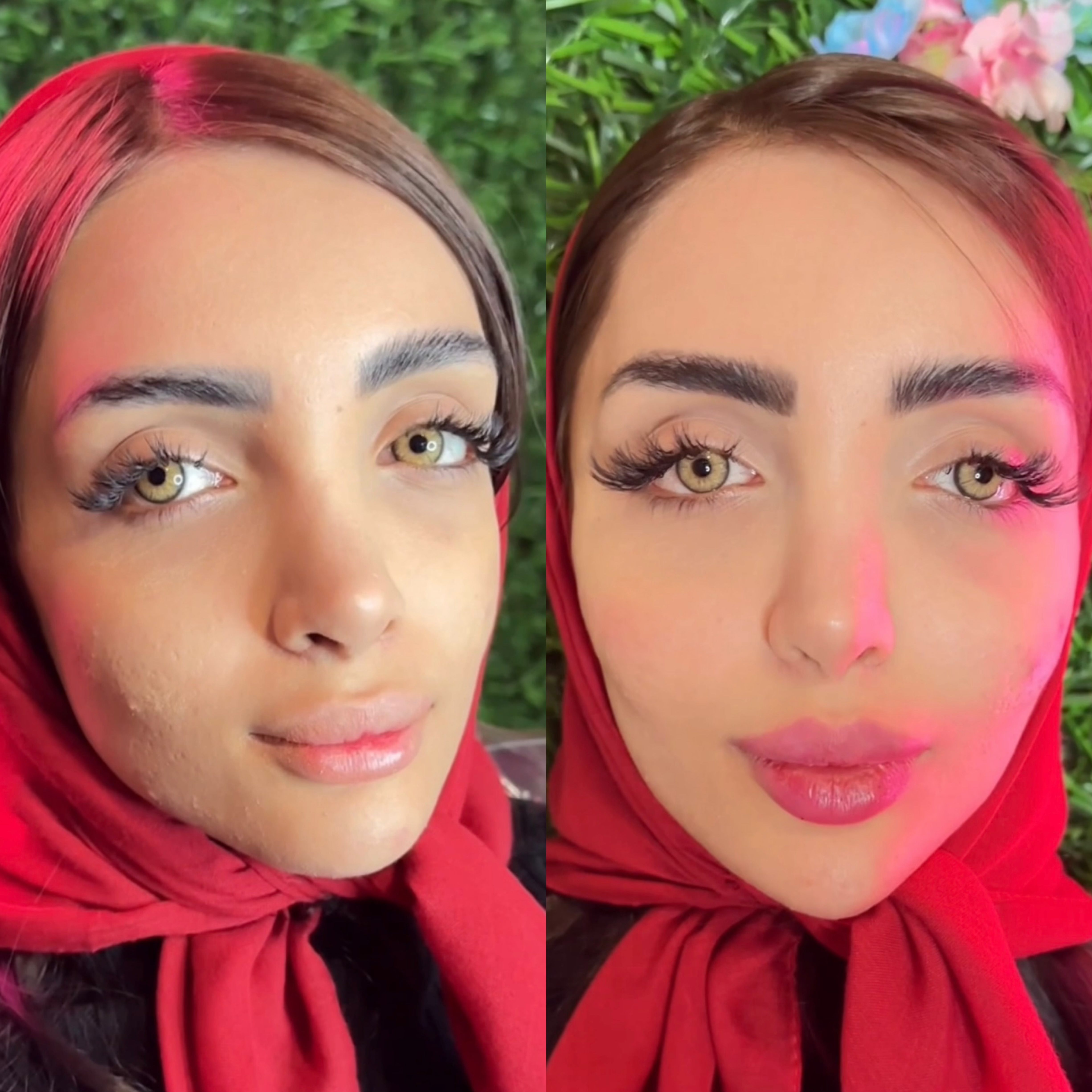خدمات ژل و بوتاکس