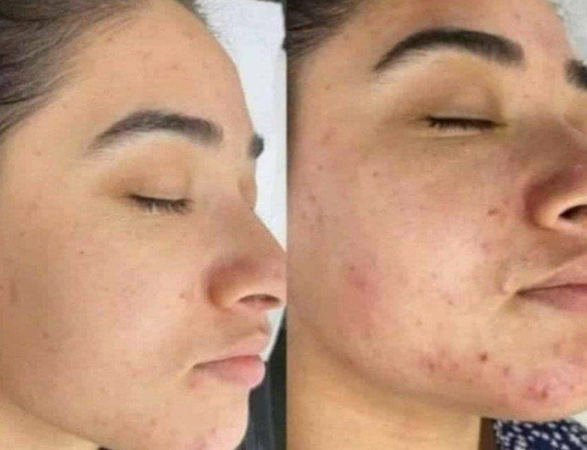 پاکسازی بدن 
