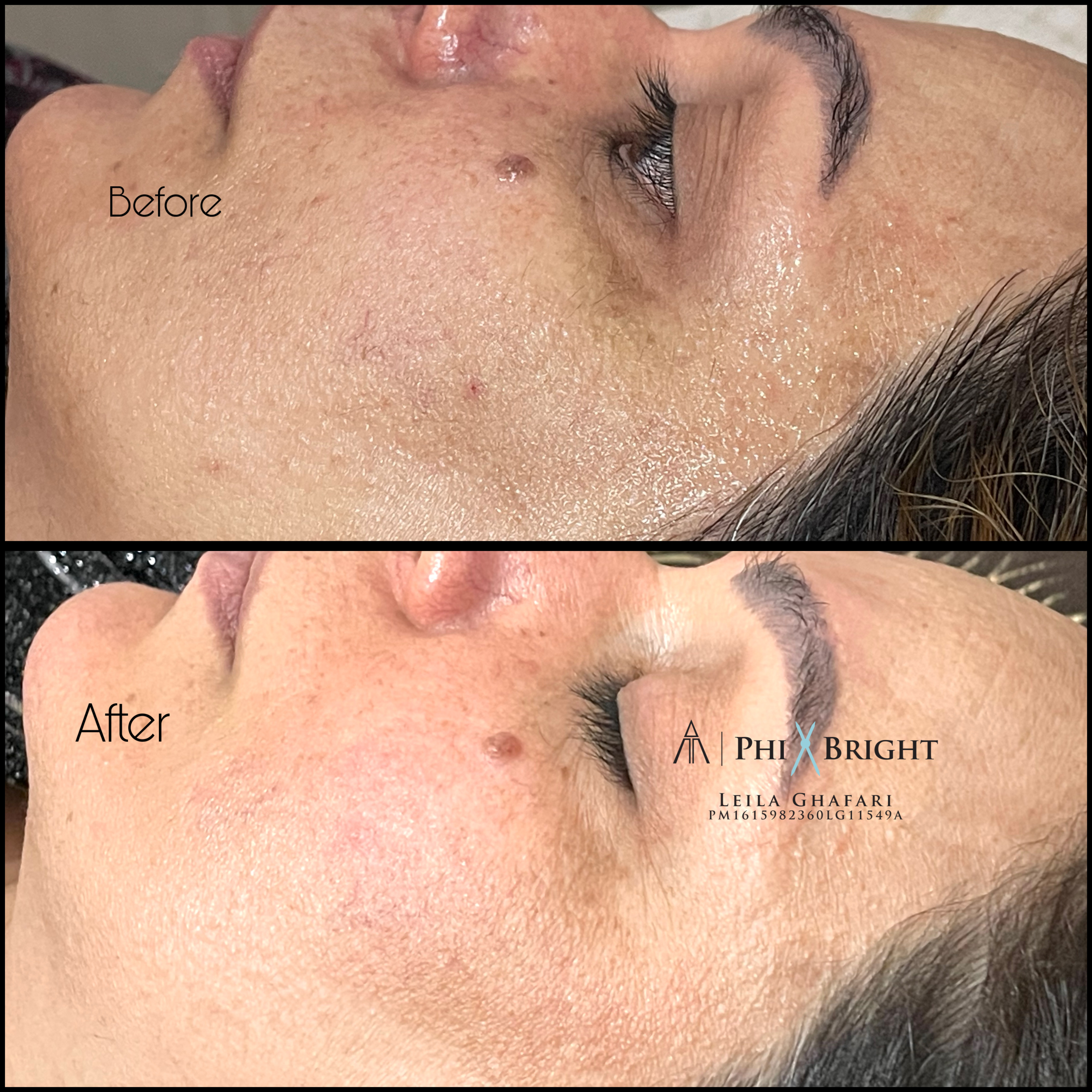 درمان قطعی انواع لک و تیرگی 