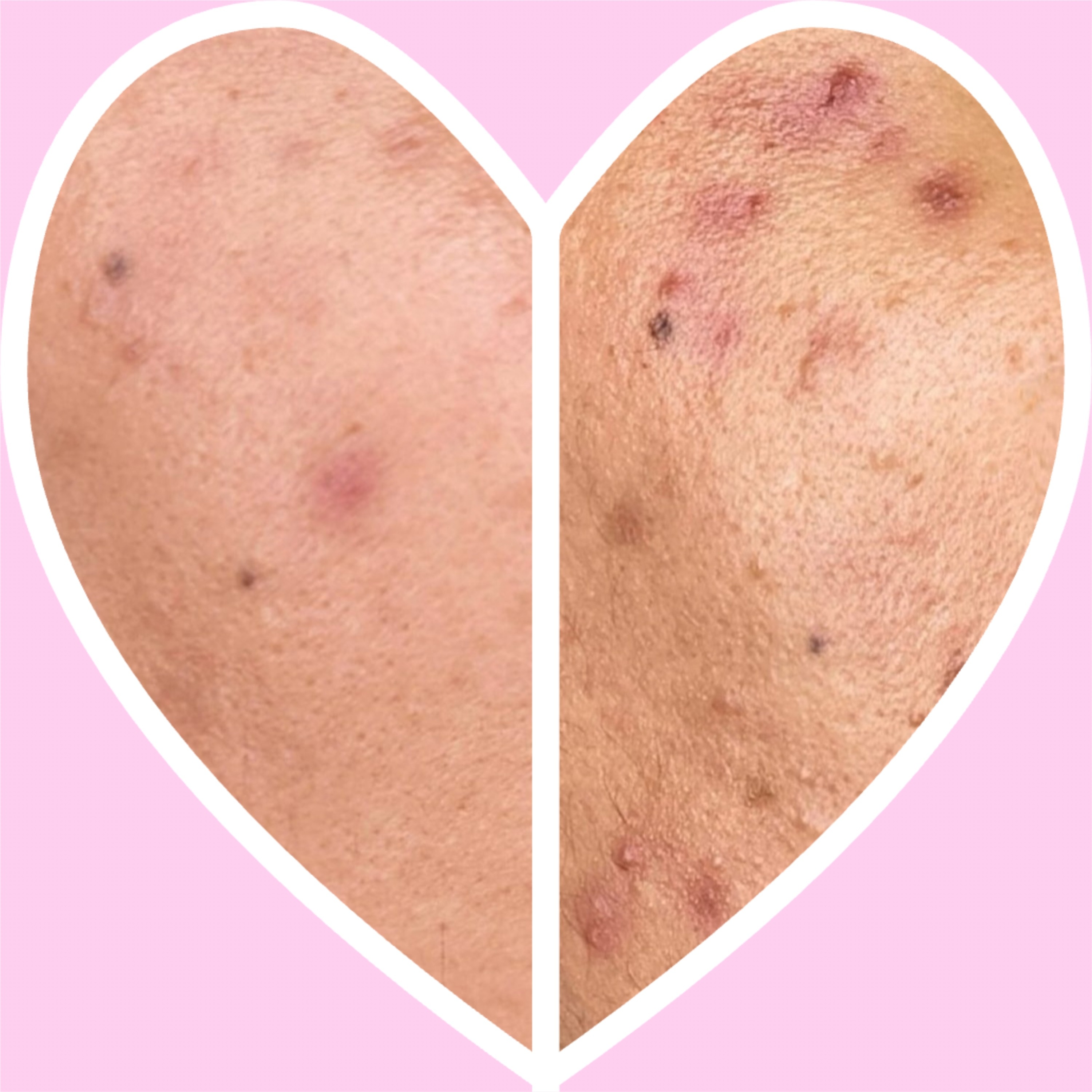 خدمات فیشال در آکادمی پوست