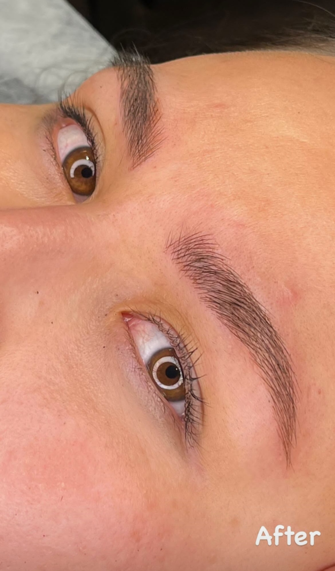 میکرو بلیدینگ نچرال بروز 