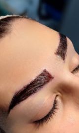 کاشت مو و ابرو در شیراز