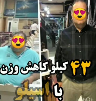 عمل زیبایی بینی