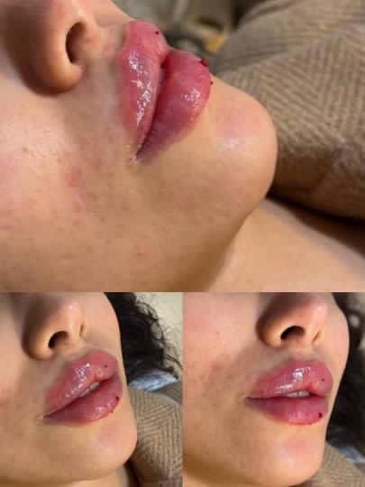 کلینیک زیبایی الا بیوتی