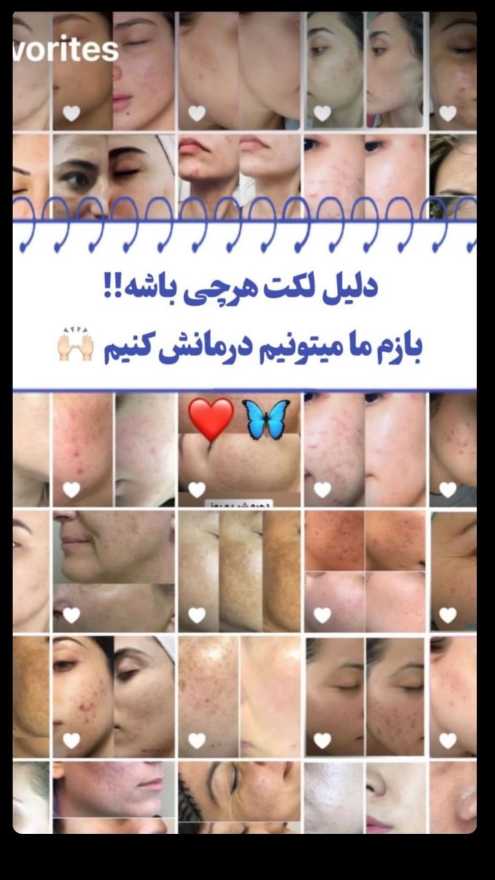 زیبایی 