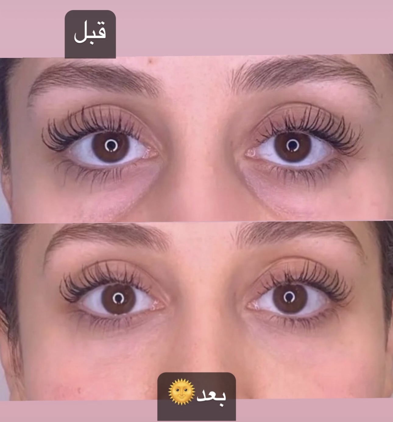 خدمات ژل و بوتاکس