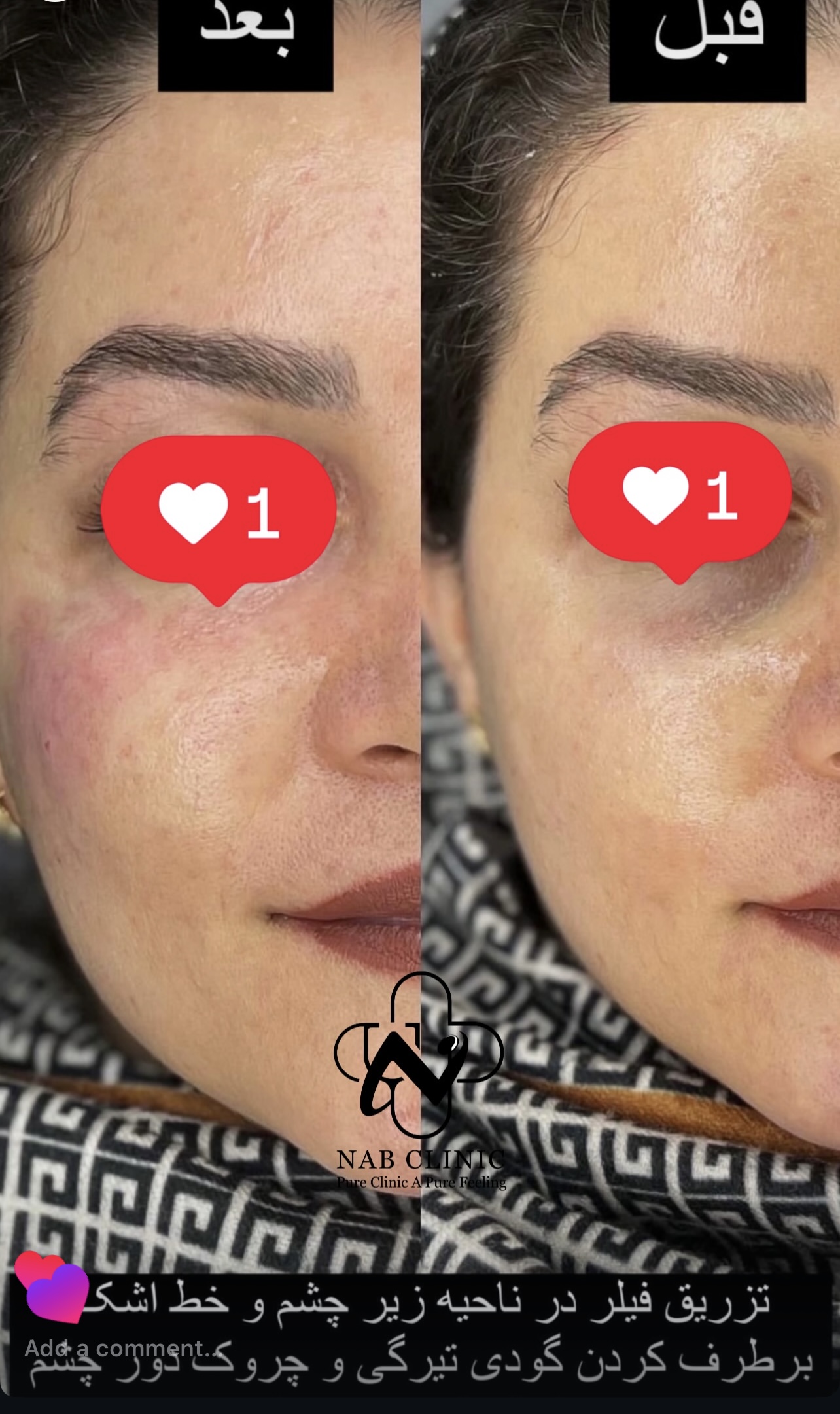  تزریق تمای کارهای زیبایی صورت و بدن