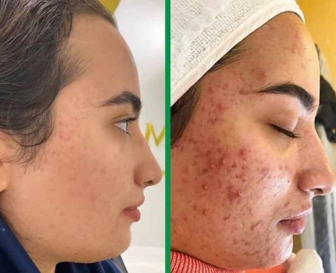 پاکسازی بدن 