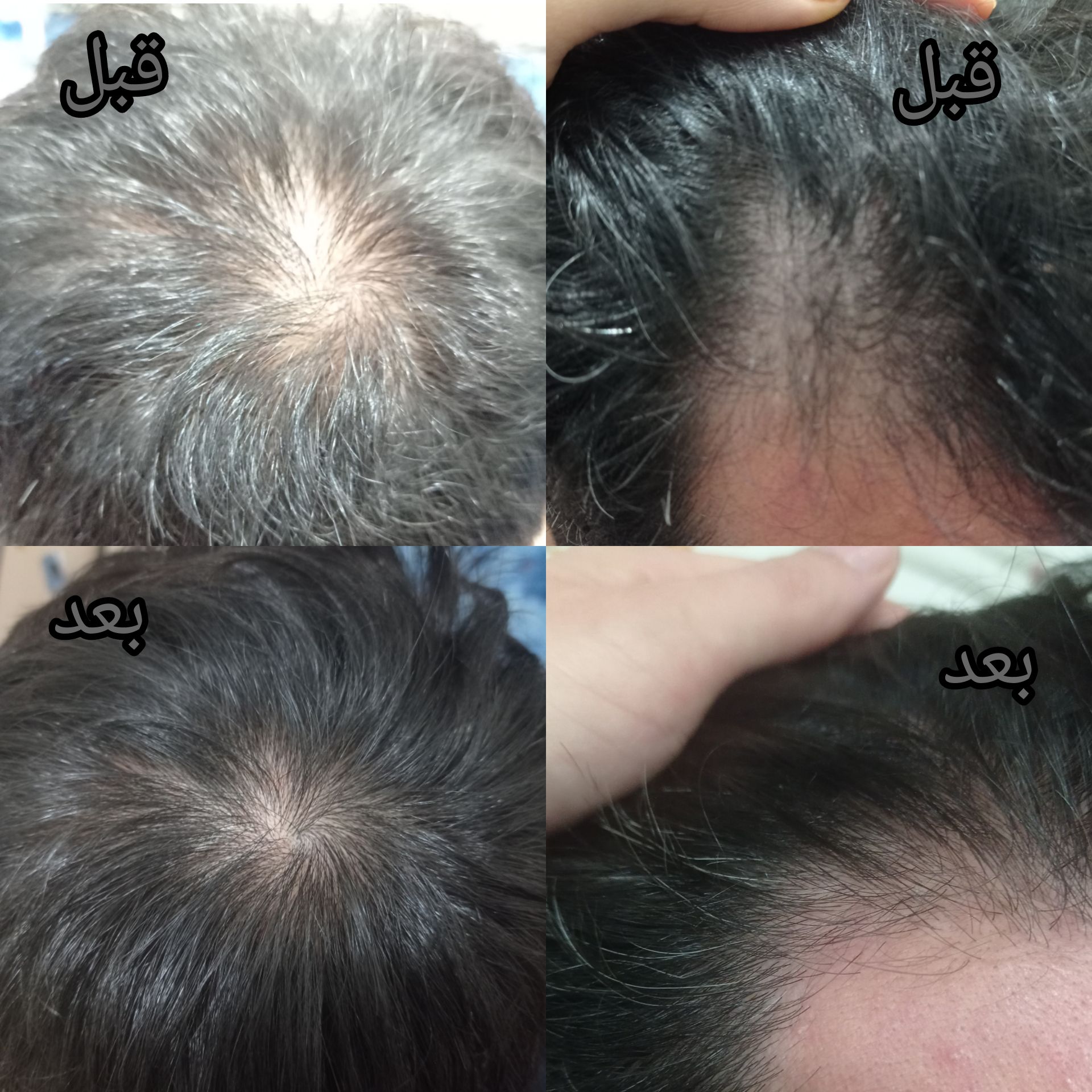 زیبایی و سلامت پوست