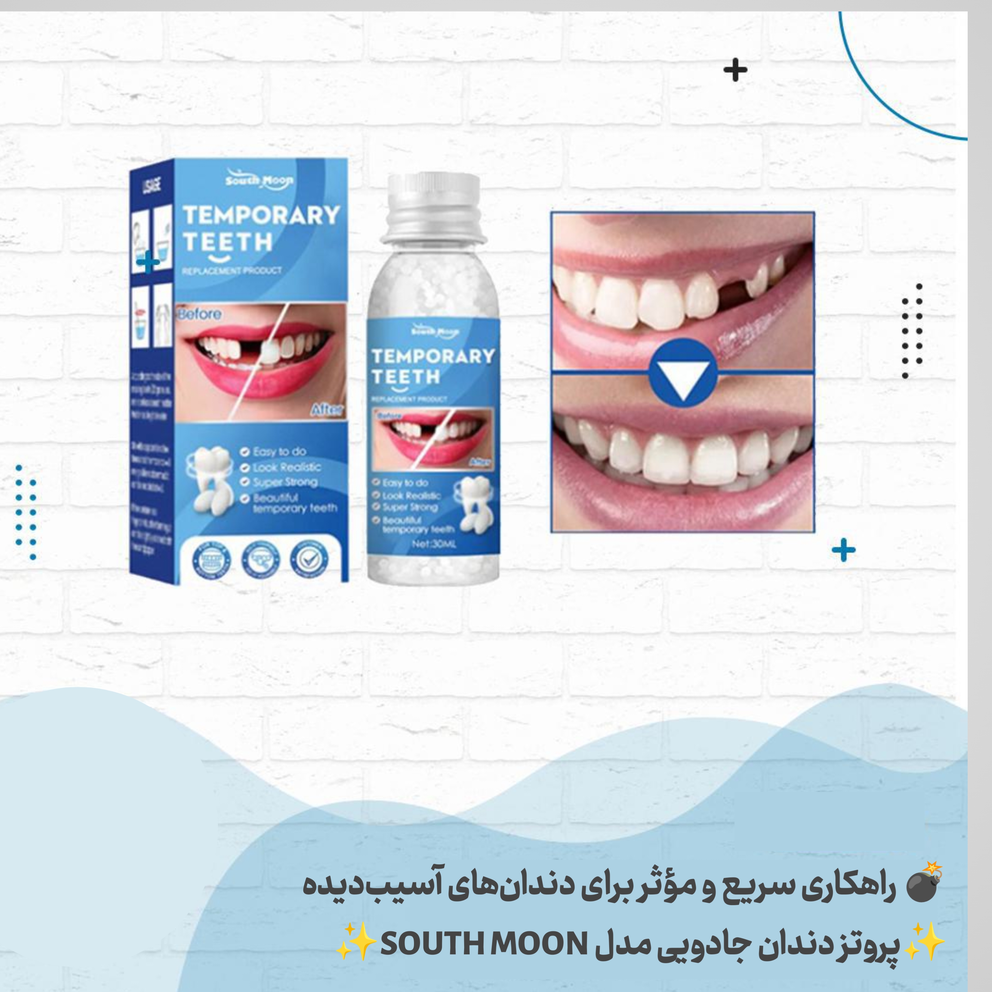 پروتز سریع
