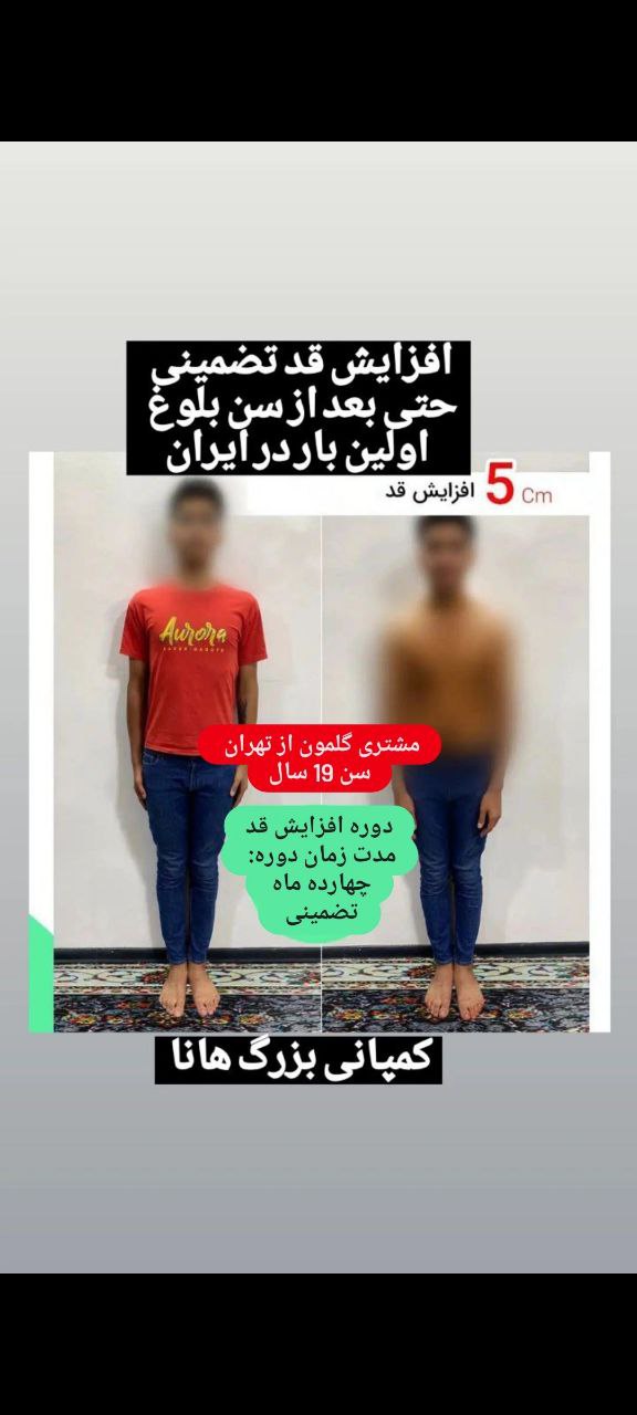 افزایش قد حتی بعد از بلوغ