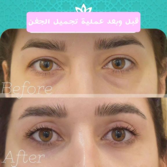 Beauty surgery and treatment